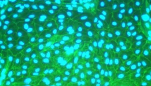 新品上市丨食蟹猴、巴马猪肾近端小管上皮细胞