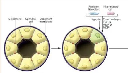 EMT与TGF-beta，那些不得不说的事儿