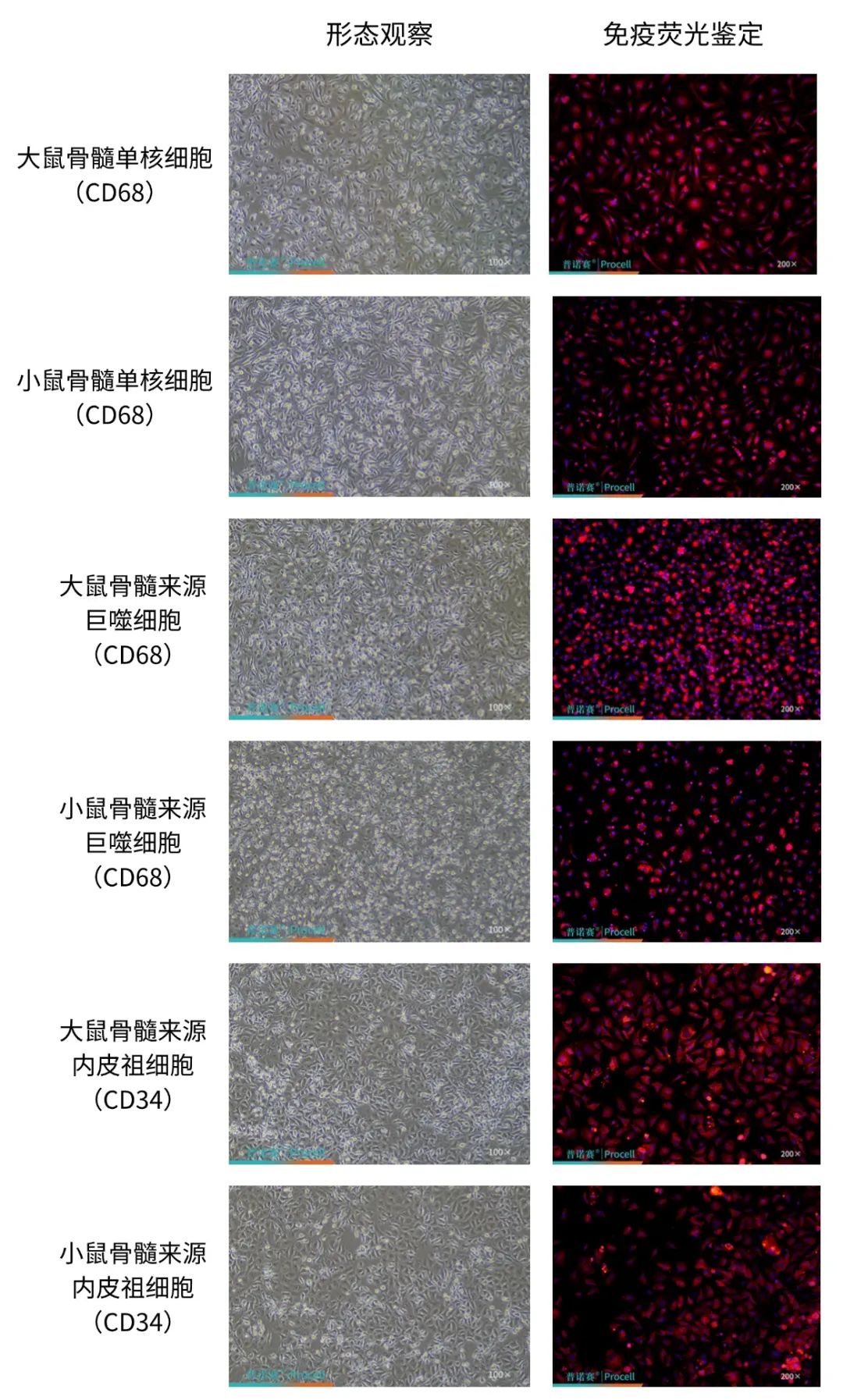 普诺赛®骨髓类原代细胞分离培养试剂盒——精准分离骨髓“细胞天团”，解锁多元研究！