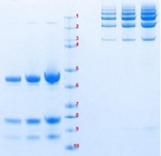 Athens-结合珠蛋白,促销，低价享品质