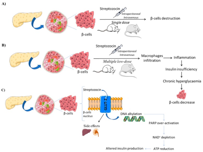 免疫缺陷+STZ：1型糖尿病干细胞疗法黄金模型