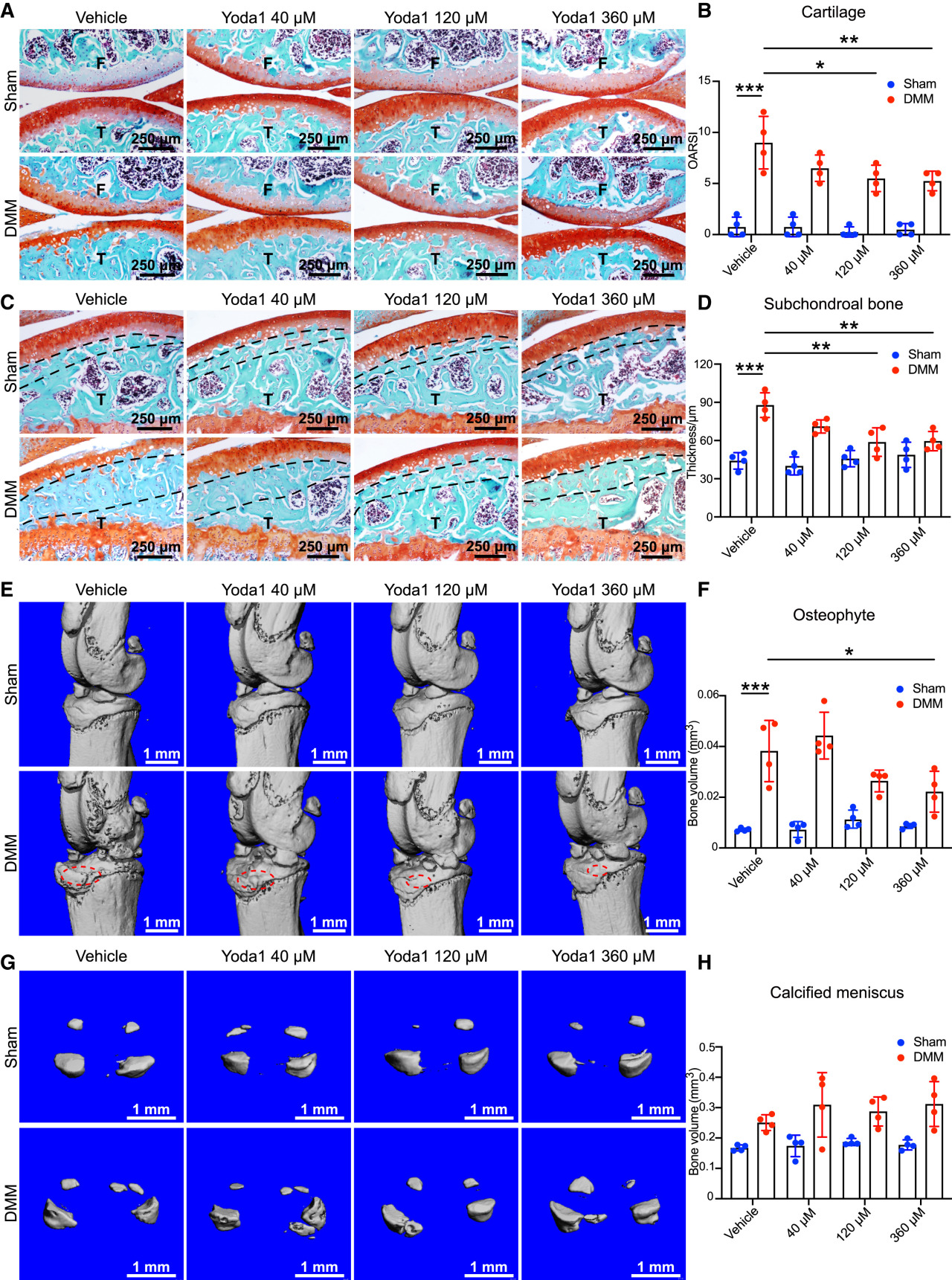 Cell | 同济大学发现软骨再生新机制，为2亿关节炎患者带来新希望