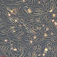 浙江(杭州)美森 人胆管癌细胞 HUH-28