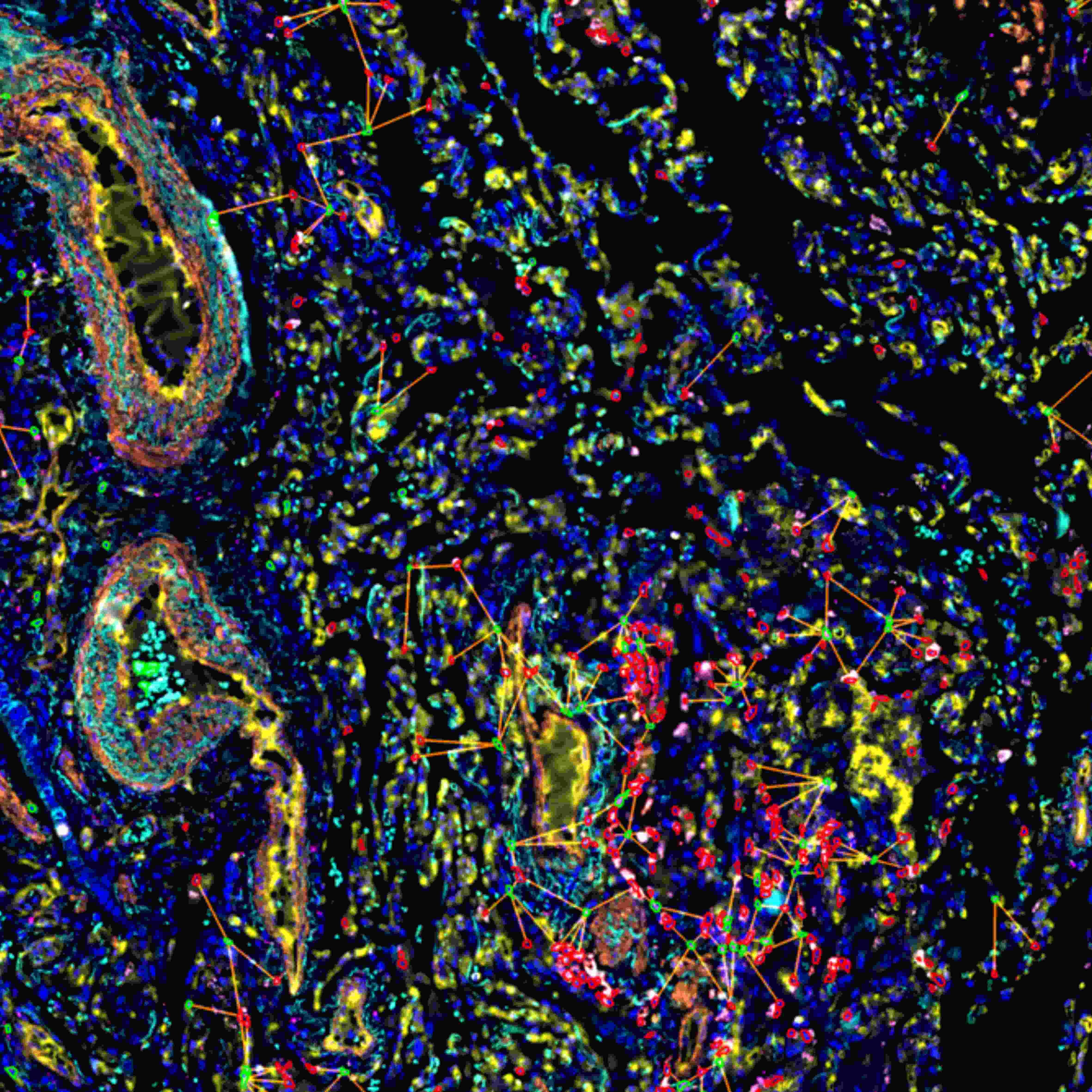 从样本到数据:TissueGnostics 全景多标记技术服务,科研效率翻倍的秘密