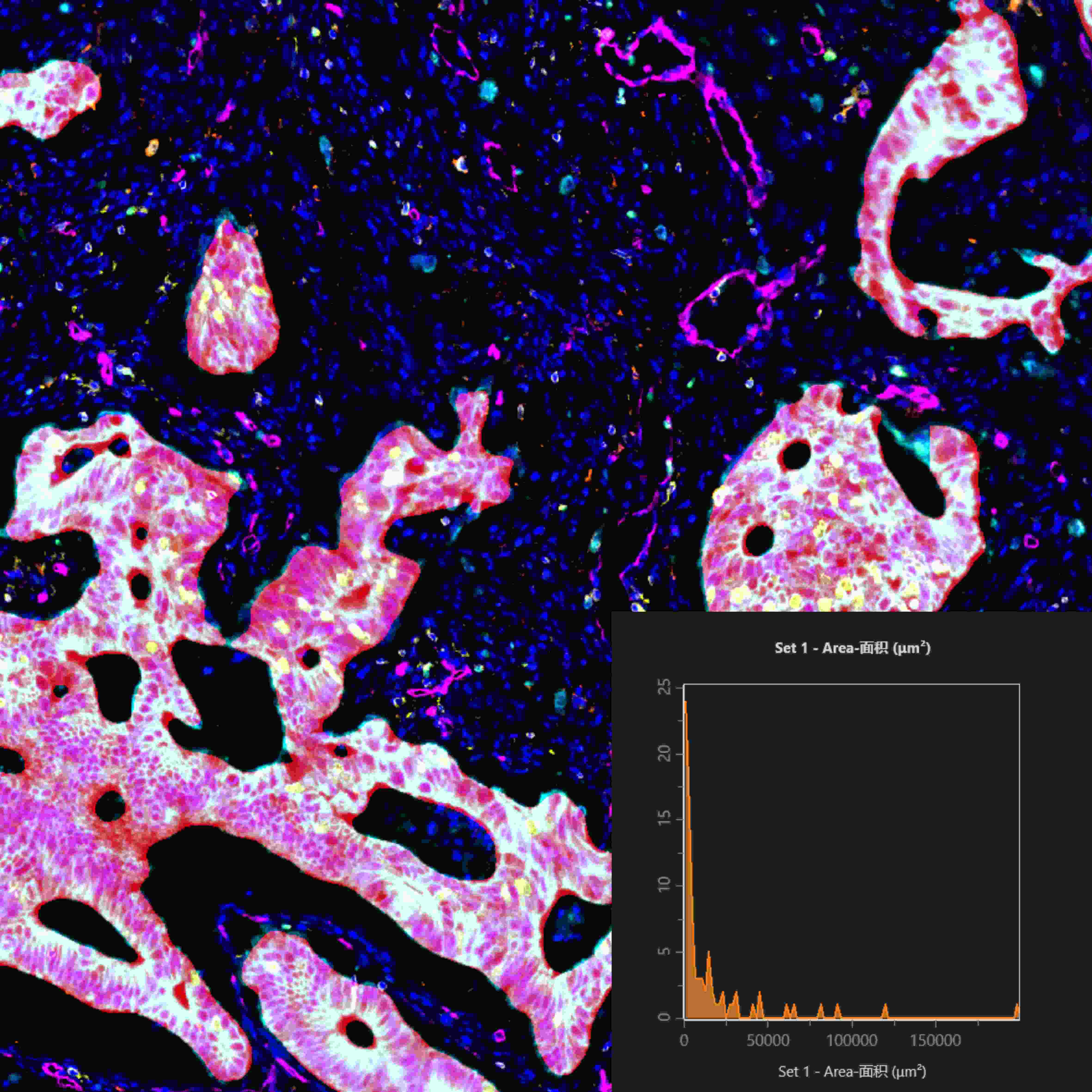 从样本到数据:TissueGnostics 全景多标记技术服务,科研效率翻倍的秘密