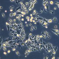 人骨肉瘤细胞143B(Luc1)现货