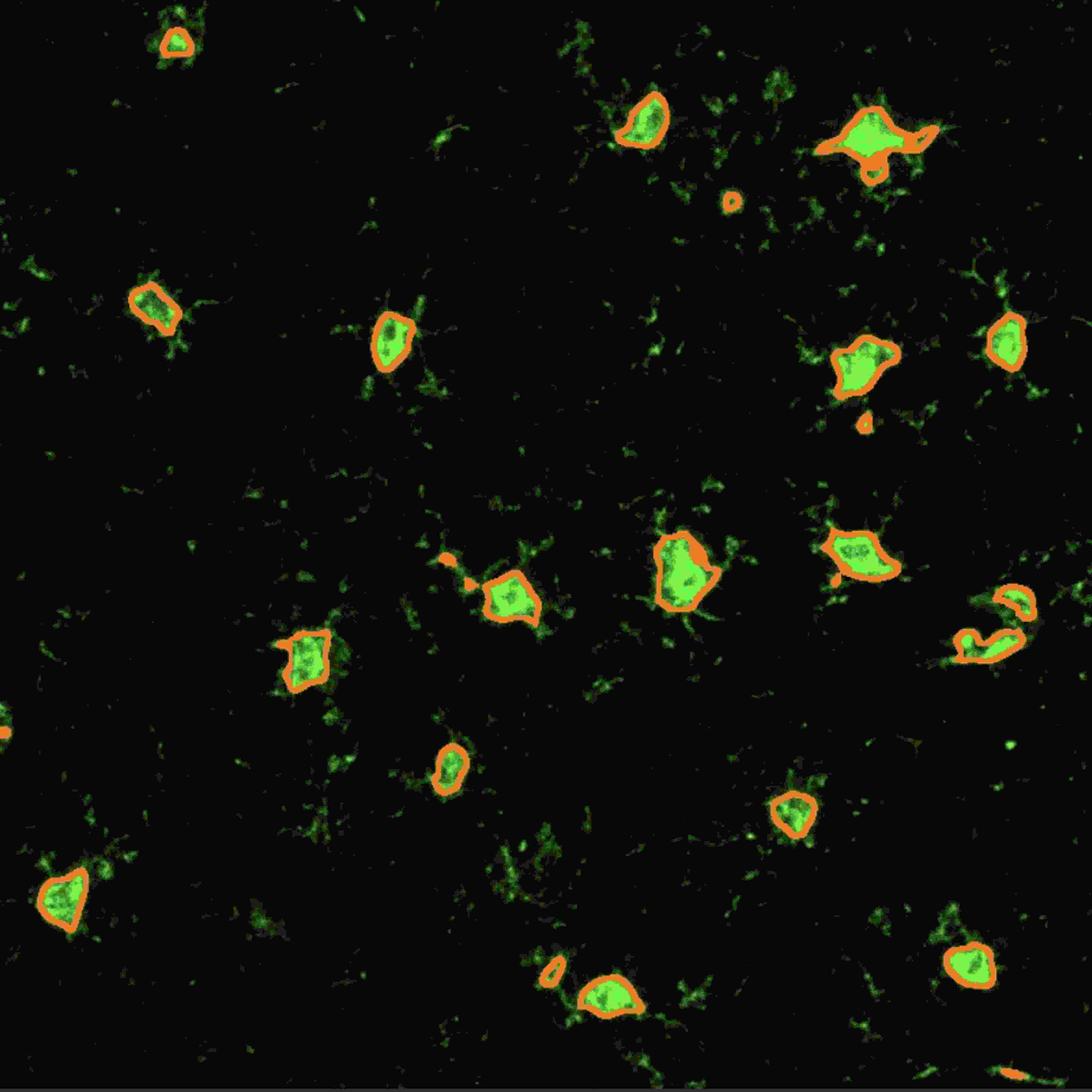 从样本到数据:TissueGnostics 全景多标记技术服务,科研效率翻倍的秘密