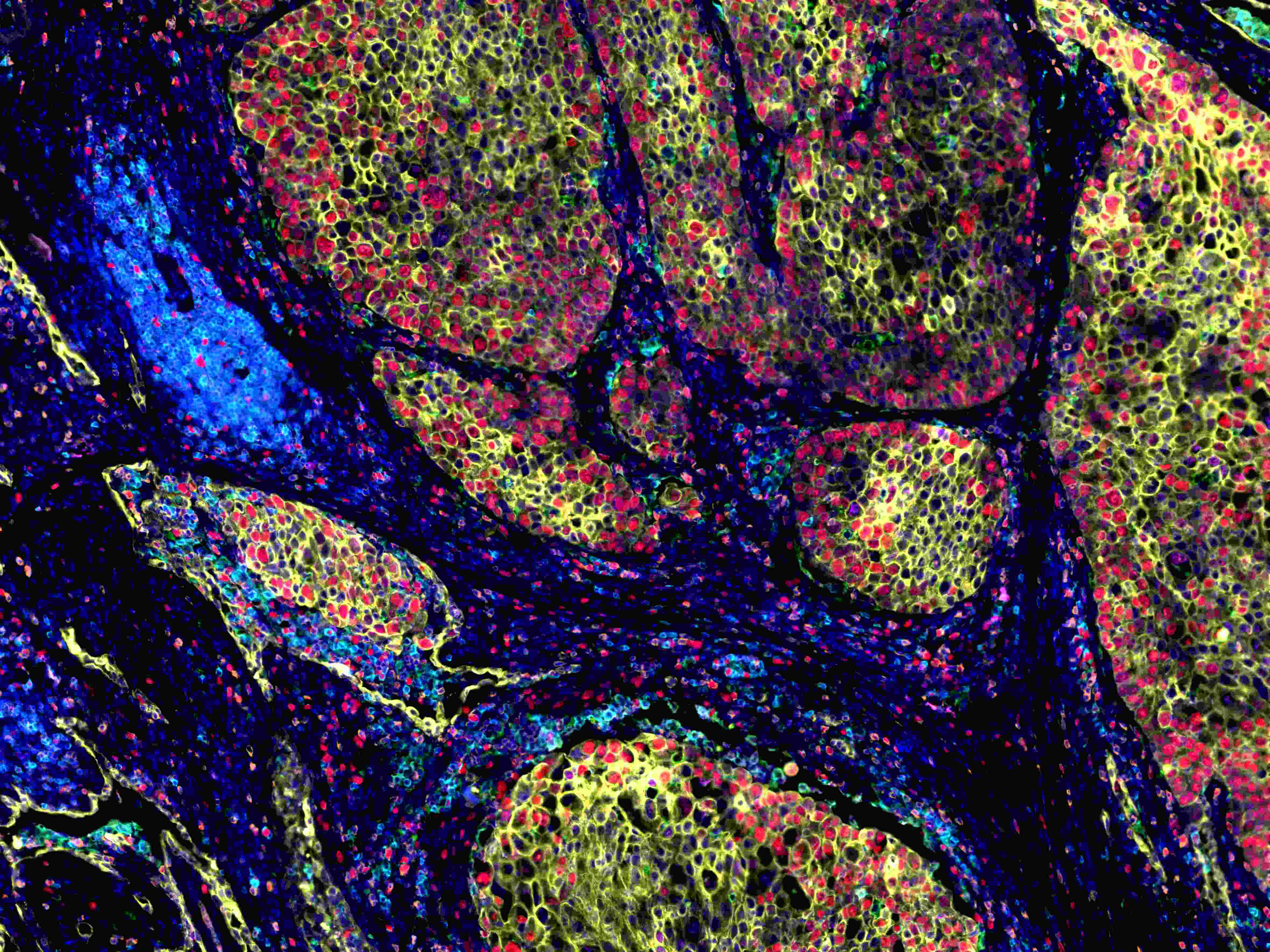 从样本到数据:TissueGnostics 全景多标记技术服务,科研效率翻倍的秘密