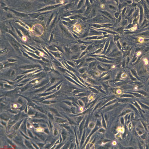 人原代宫颈成纤维细胞