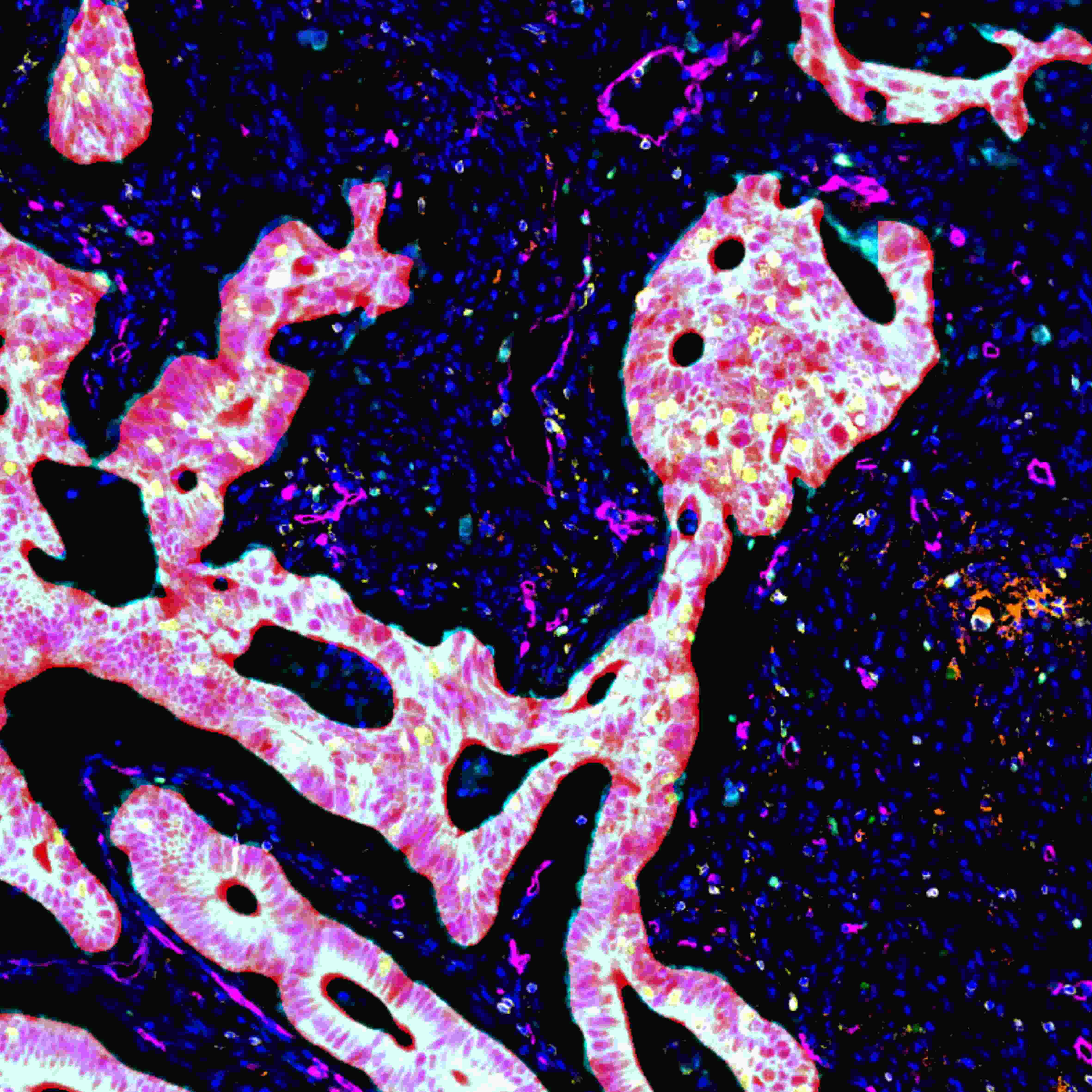 从样本到数据:TissueGnostics 全景多标记技术服务,科研效率翻倍的秘密