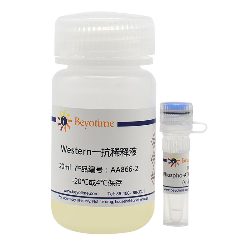 Phospho-ATM(Ser1981)抗体(小鼠单抗)