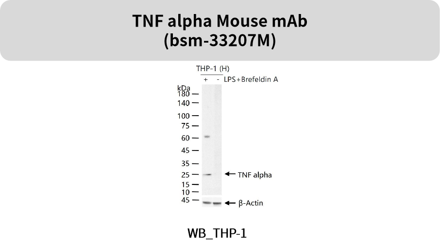 追踪“大脑火焰”:精选神经炎症抗体,为您的神经疾病研究精准导航!