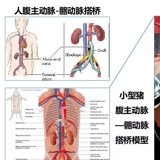 小型猪腹主动脉-髂动脉搭桥模型