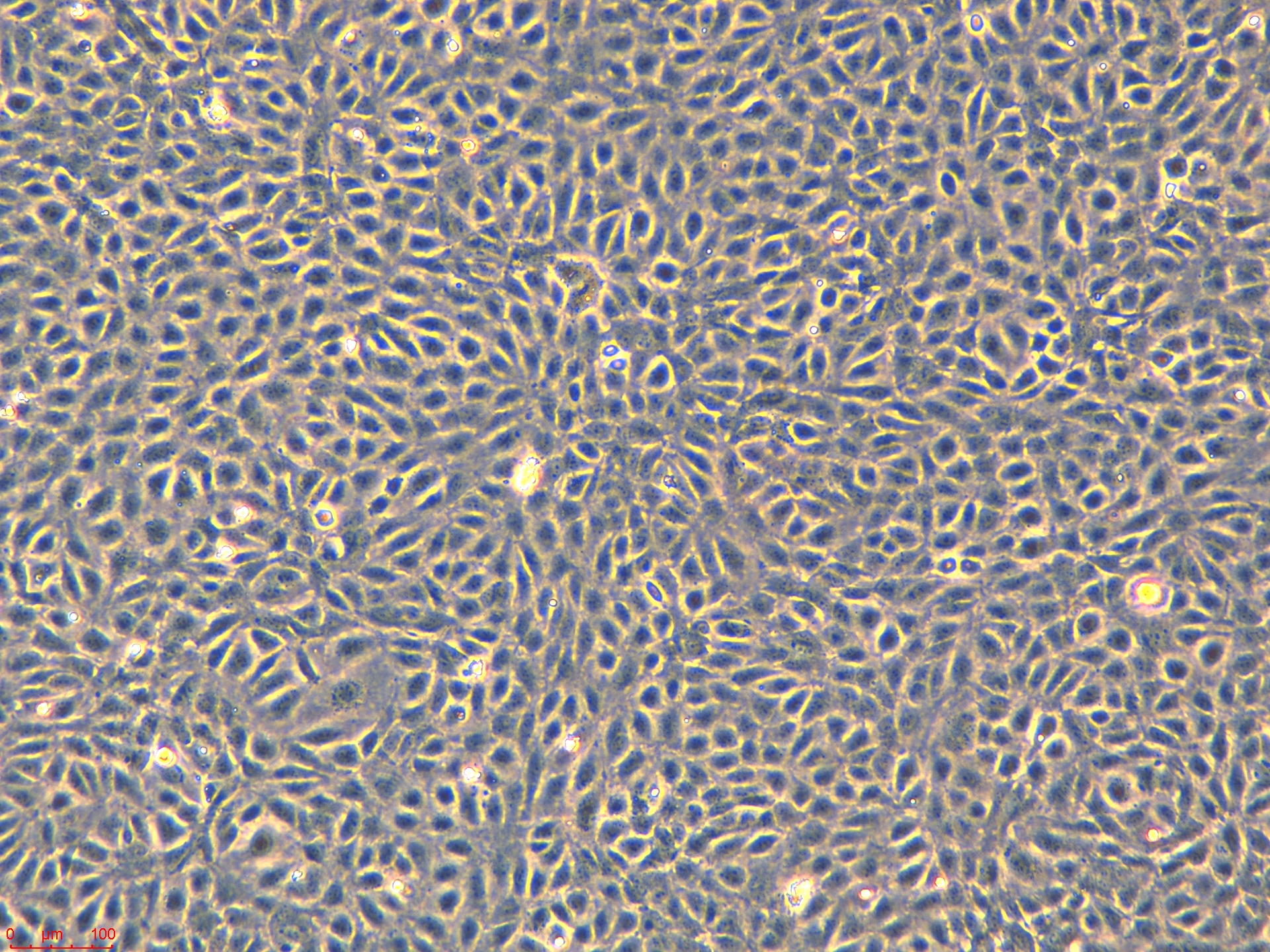 20250620_HUVEC P4.jpg