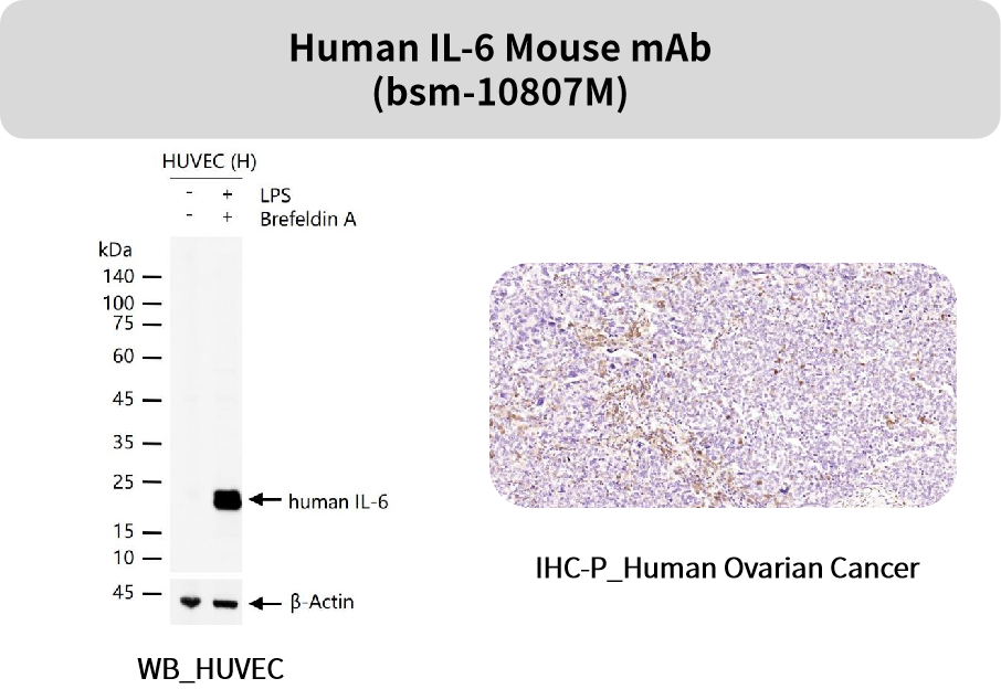 追踪“大脑火焰”：精选神经炎症抗体，为您的神经疾病研究精准导航！