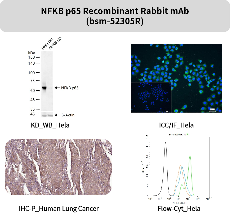 追踪“大脑火焰”:精选神经炎症抗体,为您的神经疾病研究精准导航!