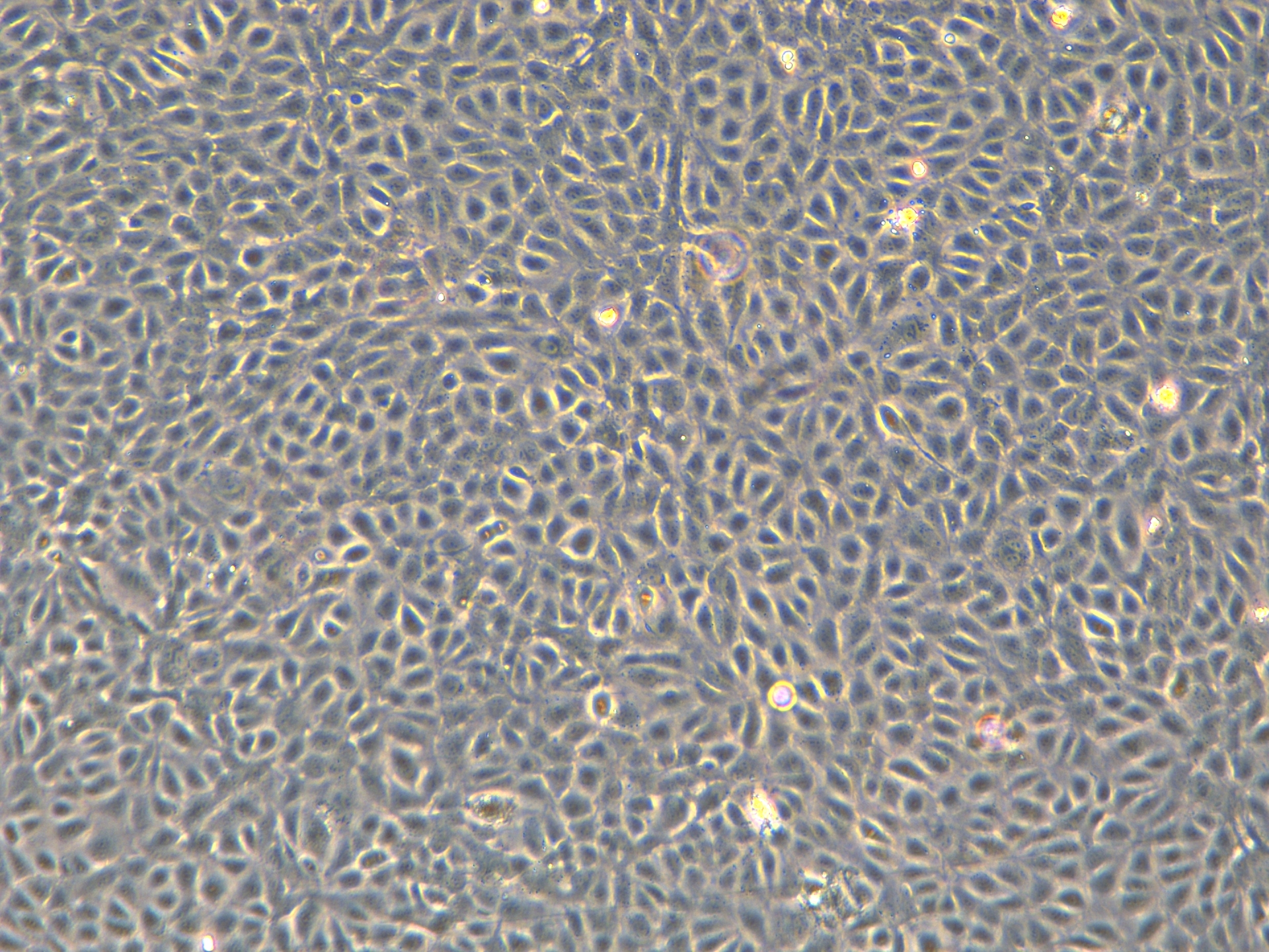 20250615_HUVEC P3_ch00.jpg