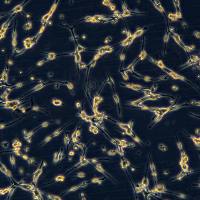 小鼠结肠癌细胞 CT-26