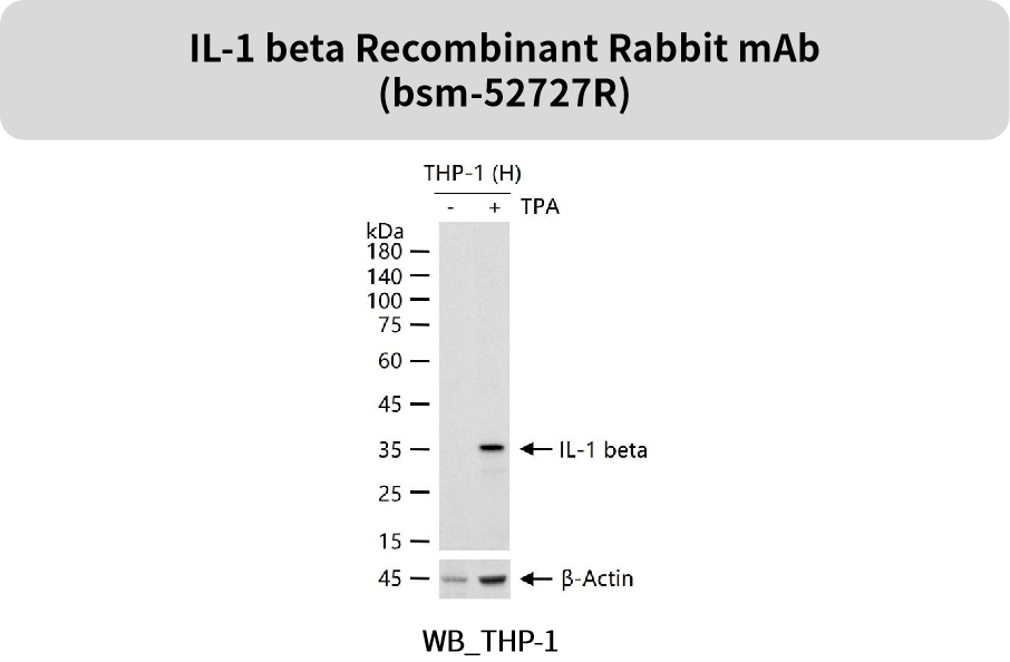 追踪“大脑火焰”:精选神经炎症抗体,为您的神经疾病研究精准导航!