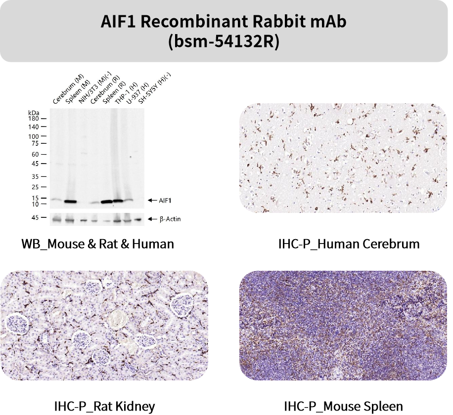 追踪“大脑火焰”:精选神经炎症抗体,为您的神经疾病研究精准导航!