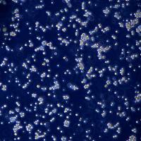 浙江美森-人结直肠腺癌细胞 COLO320DM