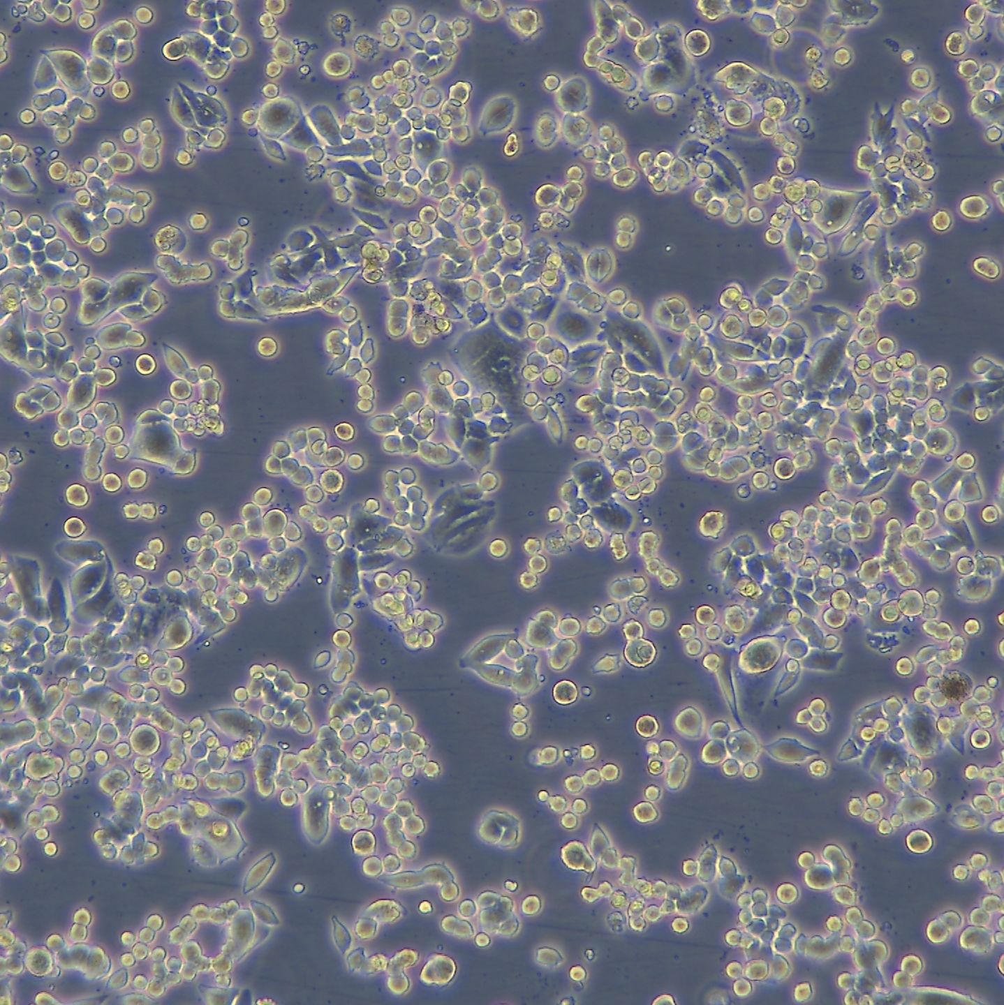 人乳腺导管癌细胞 MDA-MB-134-VI