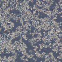 人乳腺导管癌细胞 MDA-MB-134-VI