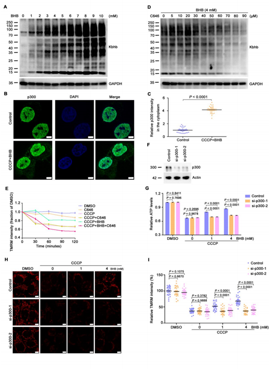 Molecular Cell丨线粒体质量控制新机制：β-羟丁酰化修饰调控线粒体囊泡生成拮抗氧化应激损伤