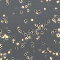 浙江美森-胃癌细胞 SNU216