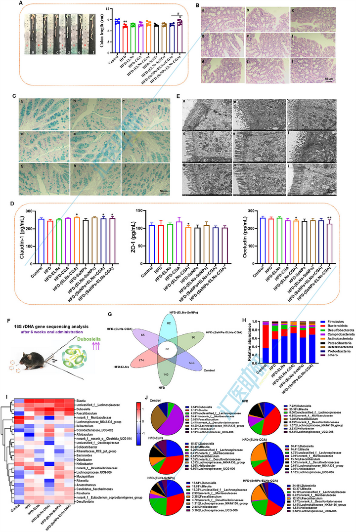 Small （IF=12.1）！中医药结合外泌体双热点，实验验证+肠道菌群+肝脏蛋白组学，双非大学在“药食同源”上打响高端局~