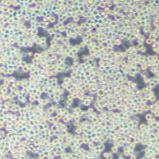 小鼠骨髓瘤细胞；SP2/0（种属鉴定）