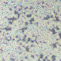 小鼠骨髓瘤细胞；SP2/0（种属鉴定）