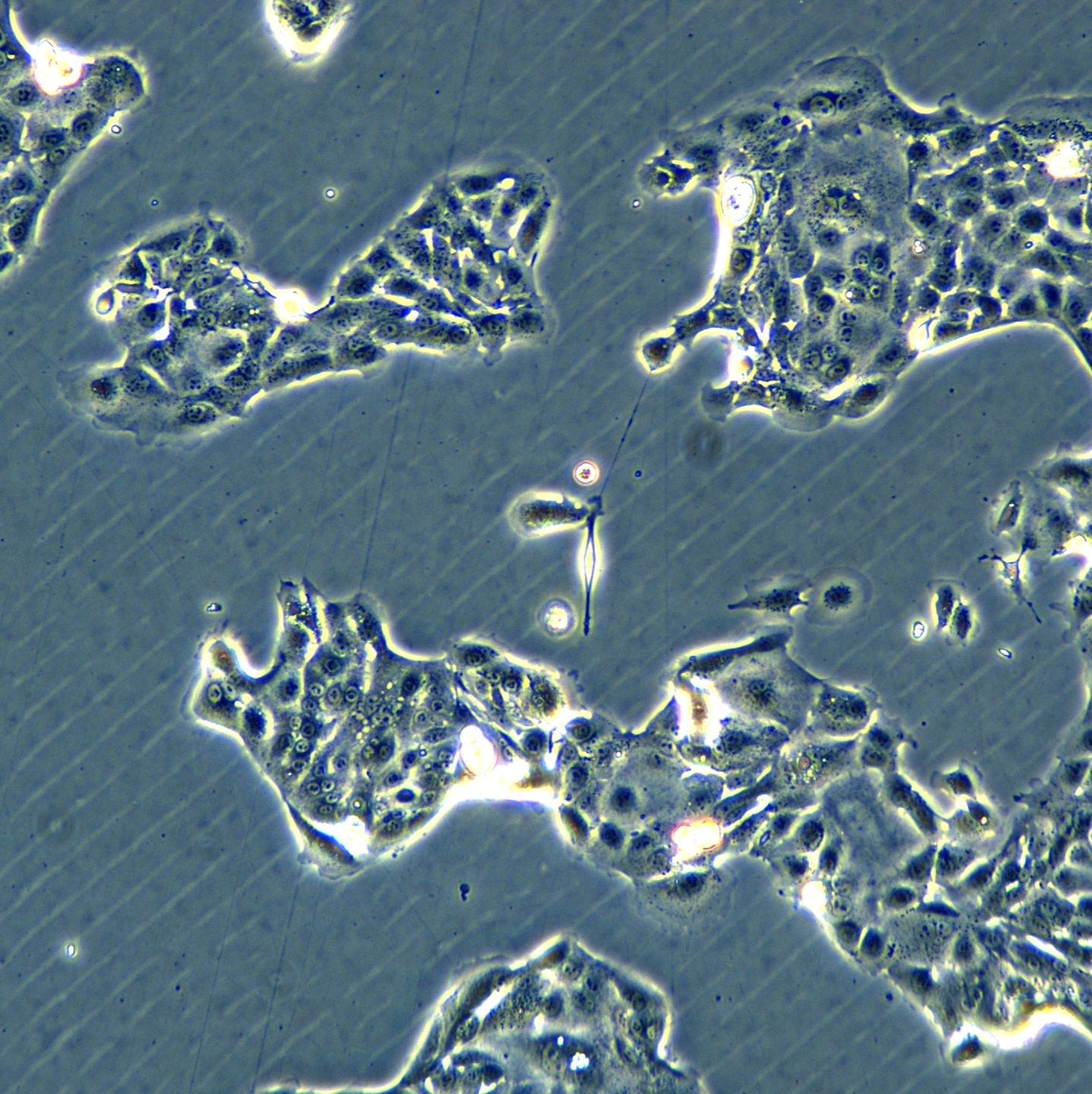 胰腺腺癌细胞 Panc04.03