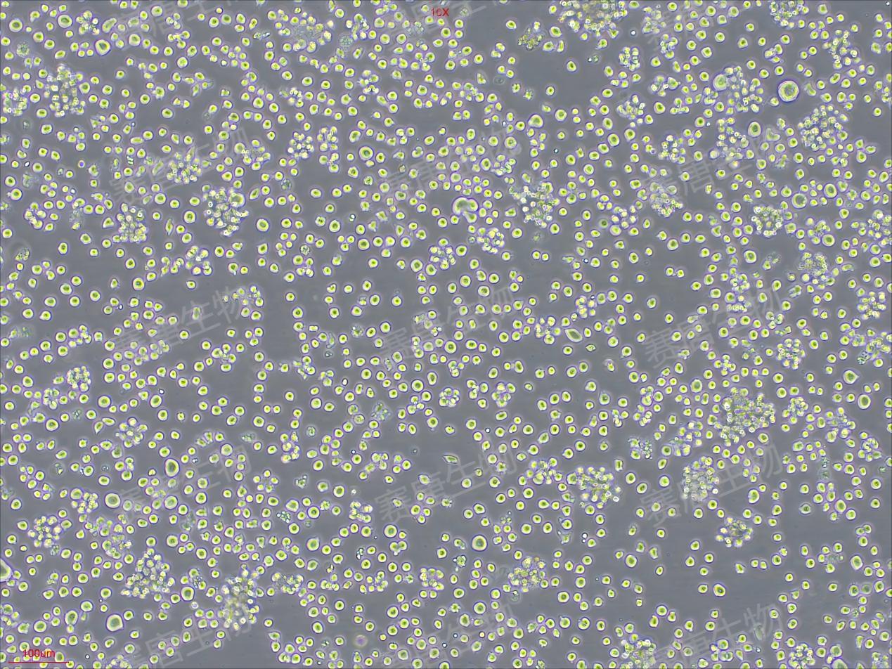 现货供应！高活性GM-CSF重组蛋白，低内毒素，支持实验验证！