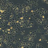 浙江美森-人非小细胞肺癌细胞 NCI-H2342