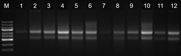 组织、细胞RNA提取试剂盒