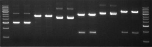 PlasPure 质粒中量制备试剂盒