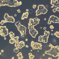 人乳腺导管癌细胞 BT-483