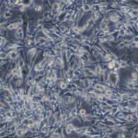 小鼠肺腺癌细胞；LA795（种属鉴定）