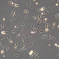 人乳腺导管癌细胞 HCC38