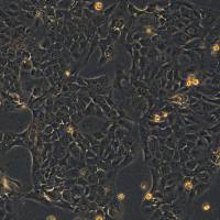 人肺腺癌细胞 HCC78