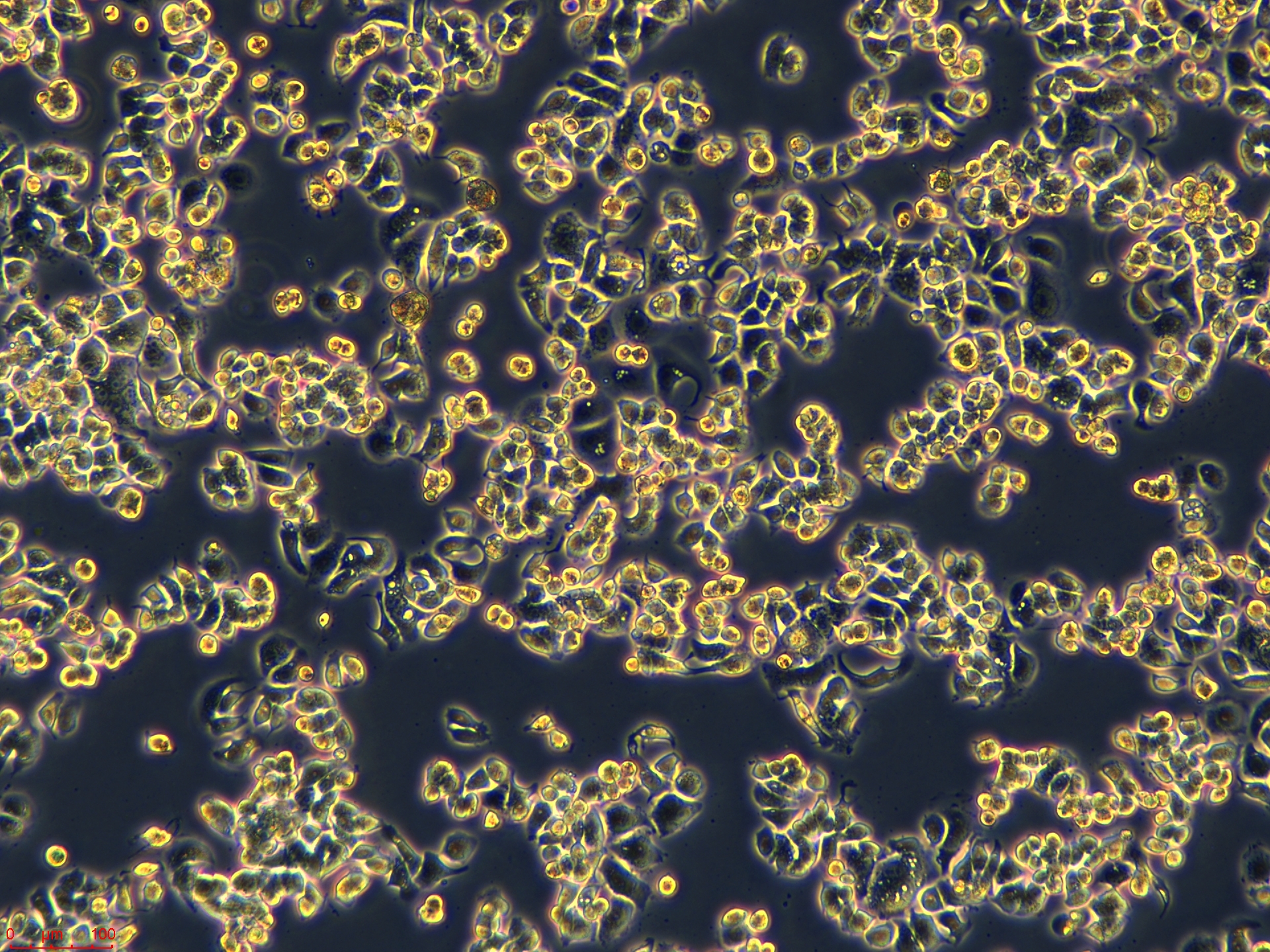 Project1001_AU565  10X_ch00.jpg