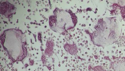 小鼠破骨细胞分化方案升级版