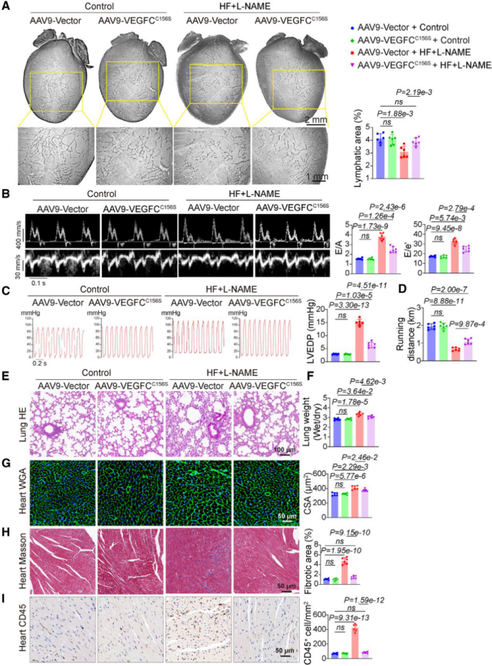 客户文章（IF=35.5）丨突破性发现！心脏淋巴管代谢异常竟是心力衰竭的 “隐形推手”