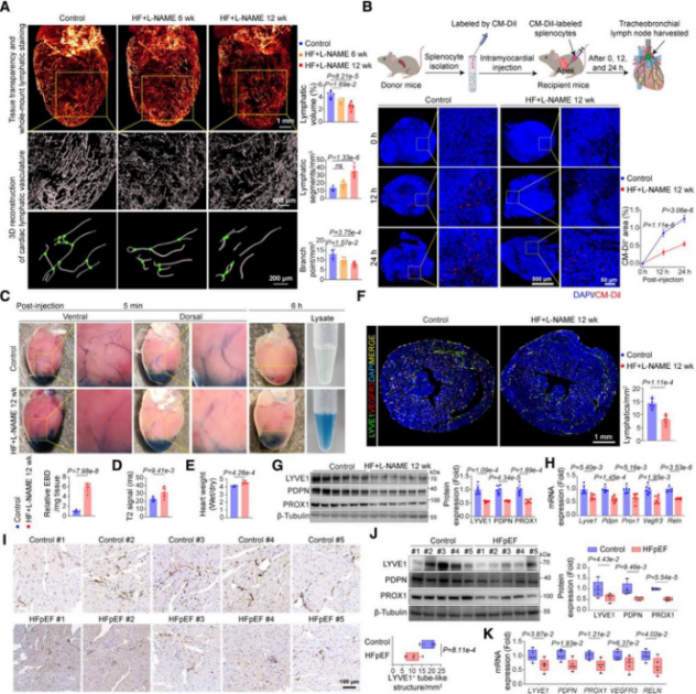 客户文章（IF=35.5）丨突破性发现！心脏淋巴管代谢异常竟是心力衰竭的 “隐形推手”