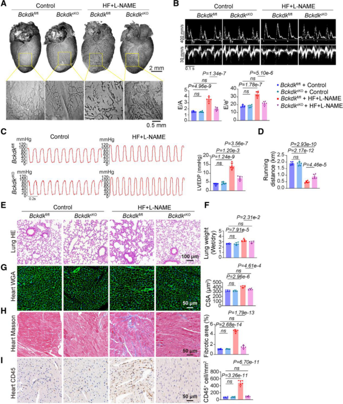 客户文章（IF=35.5）丨突破性发现！心脏淋巴管代谢异常竟是心力衰竭的 “隐形推手”