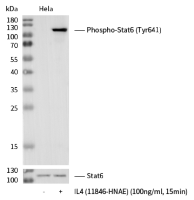 STAT6 单克隆抗体 | Phospho-Stat6 (Tyr641) Antibody, Rabbit MAb
