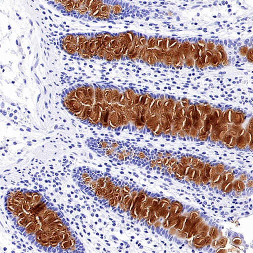 肠道黏蛋白 MUC2：从黏液屏障到疾病开关的双重身份解码