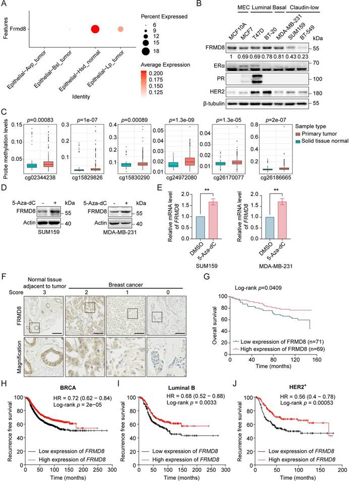 北大团队揭示FRMD8双重机制调控乳腺癌他莫昔芬耐药,利用TissueGnostics技术精准解析肿瘤微环境