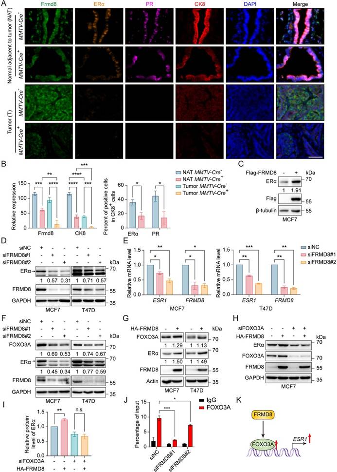 北大团队揭示FRMD8双重机制调控乳腺癌他莫昔芬耐药,利用TissueGnostics技术精准解析肿瘤微环境